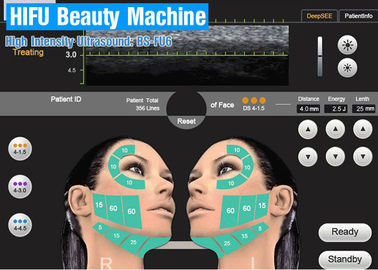 고강도 미장원에 있는 얼굴 처리를 위한 집중된 초음파 HIFU 아름다움 기계