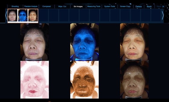 6 스펙트럼은 더 명확한 피부 문제 얼굴 피부 분석 장비를 봅니다