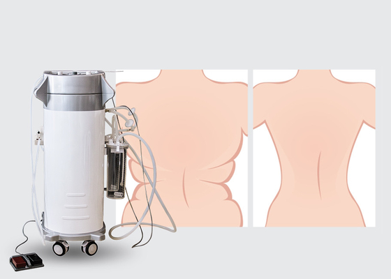 300W 상/하 뒤 지방 흡입 수술을 위한 외과 지방 흡입 수술 기계