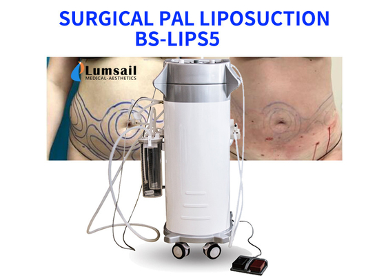 BS-LIPS5 300W 힘은 목 유방과 Chin를 위한 지방 흡입 수술 장비를 원조했습니다