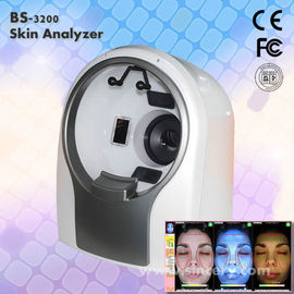 1/1.7&quot;를 가진 얼굴 3D 피부 해석기 돋보기 기계 CCD 민감화 장치