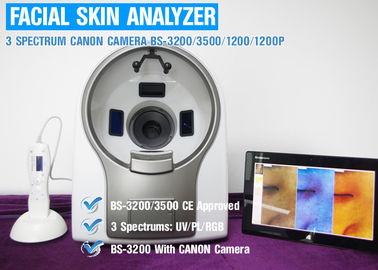7200 K 3d 영국 버전 소프트웨어를 가진 표피 피부 분석 기계