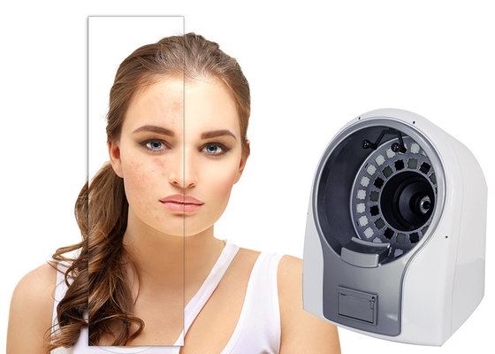 6x 광학 렌즈 Lumsail 3D 안색 피부 분석 장비
