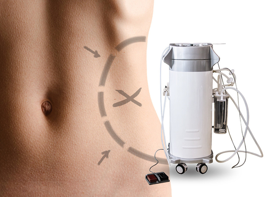 기계를 체중을 줄이는 복부/상완 외과 흡입을 위한 심미적인 외과 지방 흡입 수술 기계