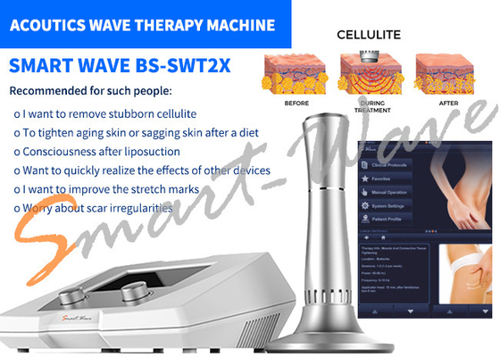 미장원 BS-SWT2X 음파 치료 기계 셀룰라이트 제거 1 년 보장