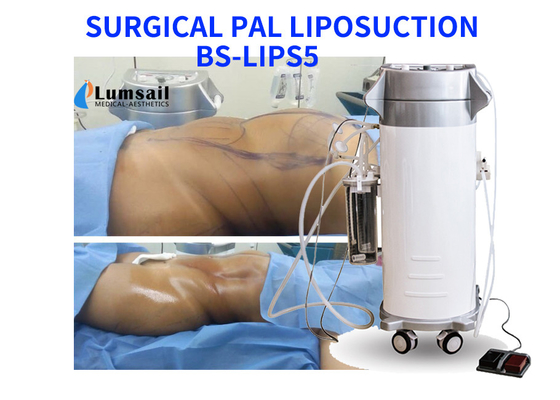 PAL 캐뉼러 세트를 가진 아름다움 장비를 체중을 줄이는 초음파 외과 지방 흡입 수술 기계